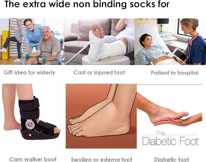 Extra brede sokken bij lymfoedeem – VitalSox